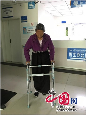 成都市第六人民医院助力巴塘县人民医院开展首例右侧人工股骨头置换术