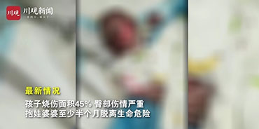 成都电瓶车爆燃事故追踪：还原送医全过程 女婴已脱离生命危险 